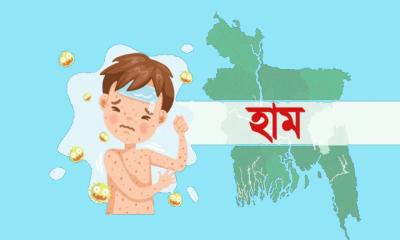 হামে আরও  ৭ শিশুর মৃত্যু
