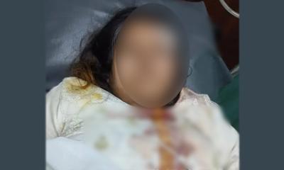 সড়ক দুর্ঘটনায় গোবিপ্রবির সহকারী অধ্যাপক আহত
