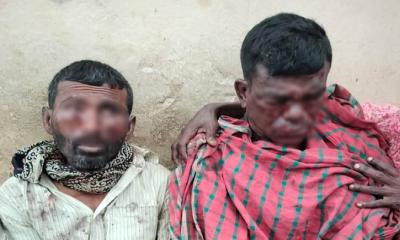 বেনাপোলে বোমা বিস্ফোরণে ৩ শ্রমিক আহত, আশঙ্কাজনক ২