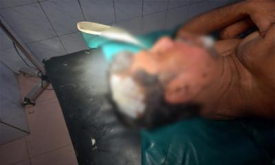 নিসচার মহাসচিব সড়ক দুর্ঘটনায় গুরুতর আহত