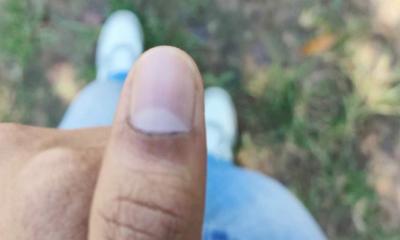 চাকসু নির্বাচন : মুছে যাচ্ছে কালি, অভিযোগ দেবে ছাত্রদল