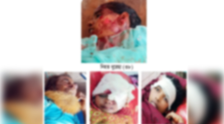 নিয়ামতপুরে সড়ক দুর্ঘটনায় নিহত ১,  শিশুসহ আহত ৫