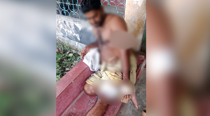 মোংলায় রড-হাতুড়ি হামলায় আহত ইউপি সদস্য ও ভাইপো
