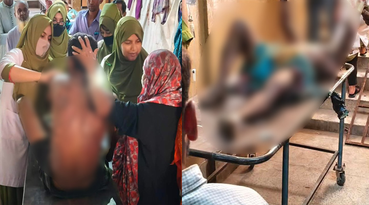 জামালপুরে সড়ক সংস্কার পিচের ড্রাম বিস্ফোরণ, দুই শ্রমিক দগ্ধ