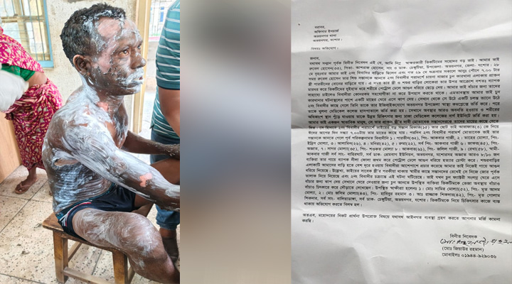 প্রাক্তন স্ত্রীর বিরুদ্ধে আগুনে পুড়িয়ে হত্যা চেষ্টা: থানায় অভিযোগ