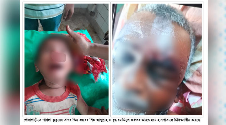 গোদাগাড়ীতে পাগলা কুকুরের তাণ্ডব শিশুসহ আহত ৫