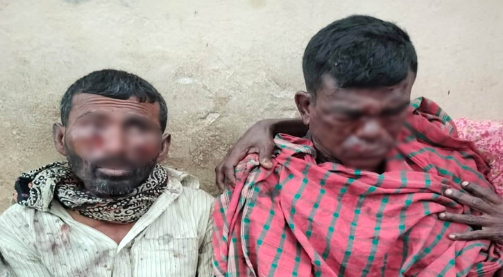 বেনাপোলে বোমা বিস্ফোরণে ৩ শ্রমিক আহত, আশঙ্কাজনক ২