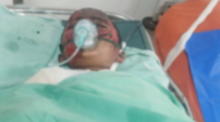 আগুনে পোড়া তাওহিদুল ইসলাম  আর নেই