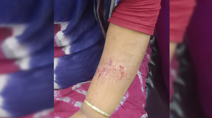 বোয়ালখালীতে দুুর্বৃত্তরা ৩ ঘন্টা তান্ডব চালিয়ে এক নারী আহত