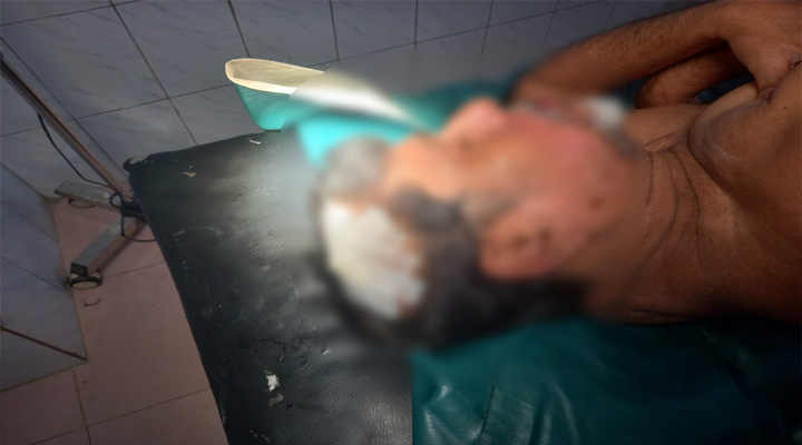 নিসচার মহাসচিব সড়ক দুর্ঘটনায় গুরুতর আহত